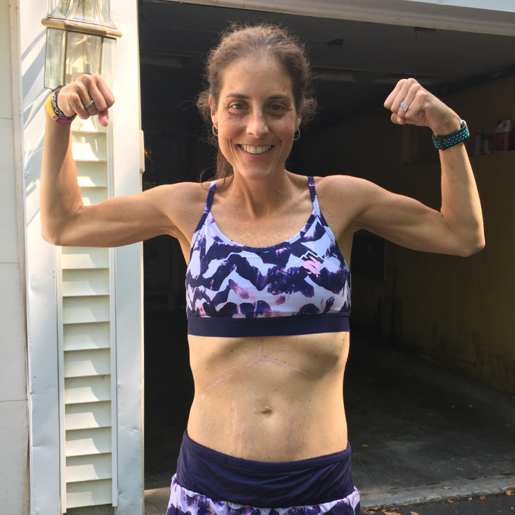 RADJournals: Caitlin Lenehan's running and liver transplant story